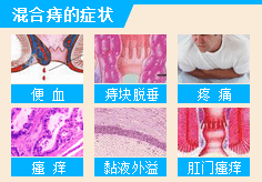 手机混合痔.gif