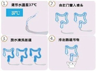 大肠水疗.png