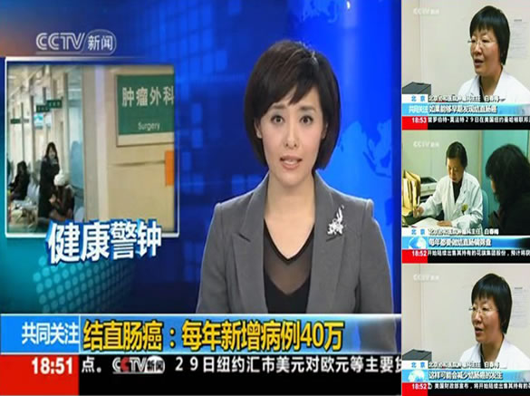新闻肠癌.jpg