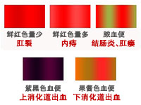 便血.jpg