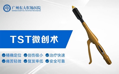 tst技术.jpg